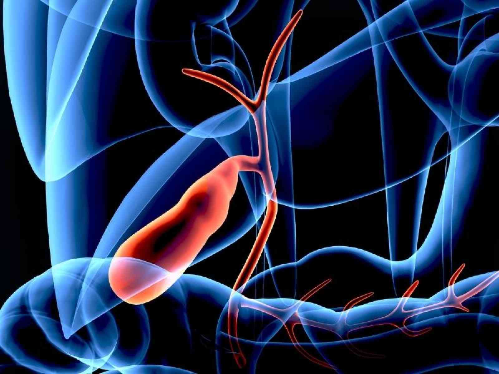 Safra Kesesi İltihabı (Kolesistit) ve Obezite | Dr. Karabuğa